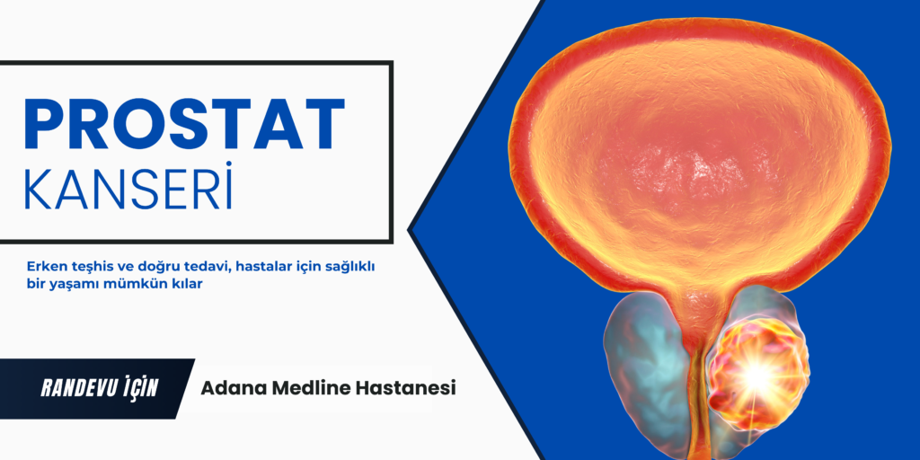 Prostat Kanseri